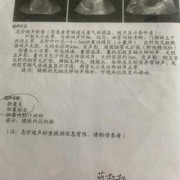 孕期胆囊炎（孕期胆囊炎犯了怎么办）