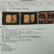 胎儿三围（做三维宝宝不动怎么办？我是下午去做检查，是否有问题呢）