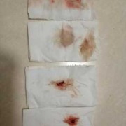 孕期末次月经（什么叫做末次月经）
