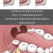 孕期智齿疼（孕期智齿疼痛难忍怎么办）