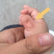 一个月的宝宝老是吃手指，是没吃饱还是怎么回事啊,胎儿 吃手