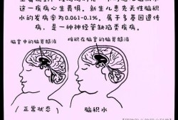 孕期胎儿脑积水的原因（孕期胎儿脑积水的原因）