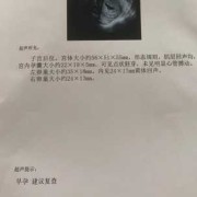 胎儿没胎心是缺叶酸（怀孕有40天了，检查看不见胎心胎芽，这是怎么回事呢）