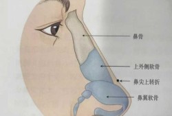 鼻梁骨短怎么办,胎儿鼻骨偏短会导致什么