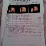 胎儿40mm（23周股骨长40mm正常吗？才做的彩超检查，上次检查胎儿还偏小了）