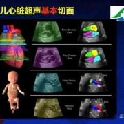 胎儿心动图（胎儿心动图主要检查什么）