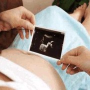 宝宝练习趴着抬头翻过来怎么翻,四维胎儿趴着怎么尽快转身