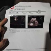 怀孕83天是几周和几个月啊,怀孕83天