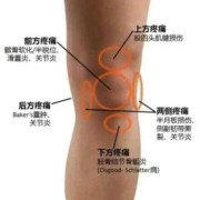 孕期膝盖痛（孕期膝盖痛什么原因）