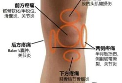 孕期膝盖痛（孕期膝盖痛什么原因）
