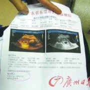 怎样看胎儿体重（怎样看胎儿体重b超单）