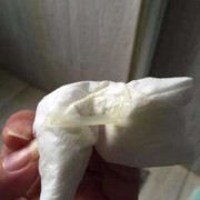 孕期白带粘稠像鼻涕
