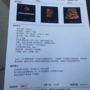 胎儿nf（有懂孕期NF增厚的大神吗）