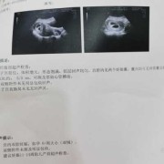 怀孕几周有胎心胎芽,一般胎儿几周有胎心胎芽