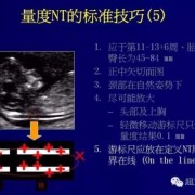 胎儿颈后透明层的意义（颈项透明层是皮肤吗）