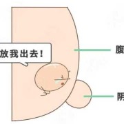 宝宝隐睾手术怎么做,孕期怎么避免胎儿隐睾发生