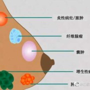 孕期乳晕周围（怀孕4个月，为什么乳房周围变黑）