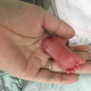 孕28周胎儿体重（怀孕28周胎儿体重2斤多一点，宝宝会不会很瘦）