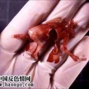 胎儿流产有哪些症状（胎儿流产有哪些症状和反应）