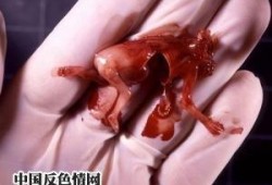 胎儿流产有哪些症状（胎儿流产有哪些症状和反应）