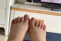 孕期脚水肿（我怀孕37周了，双脚开始肿了）