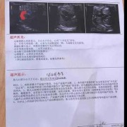胎儿心脏超声（胎儿心脏超声多少周做合适）