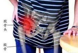 孕期大腿筋疼（孕期大腿筋疼怎么回事）