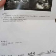 积液对胎儿有影响吗（怀孕宫颈积液对胎儿有影响吗）