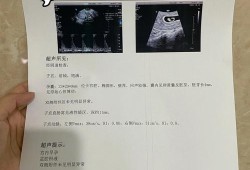 胎心偏低会影响胎儿吗（有胎芽胎心孕酮低没事吗）