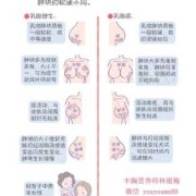 咳嗽会导致乳腺增生疼痛感加重么,孕期乳腺增生会加重吗怎么办