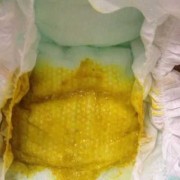 二个月胎儿（2个月宝宝放屁有大便）