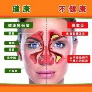 鼻炎引起咳嗽如何治疗怎么回事,孕期鼻炎咳嗽对胎儿有影响吗