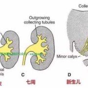 胎儿左肾集合系统分离是怎么回事,胎儿肾脏缺失原因