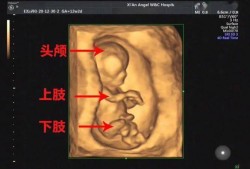 三维胎儿图（二维三维四维空间区别）