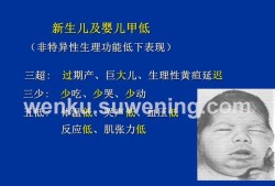新生儿患先天性甲状腺低下症服药会和正常娃娃一样发育吗,孕妇甲减会影响胎儿发育吗