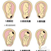 胎儿枕位图（六个月宝宝枕部是哪里）