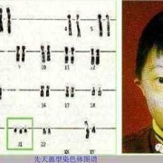 胎儿怎样排除是唐氏儿（胎儿怎样排除是唐氏儿呢）
