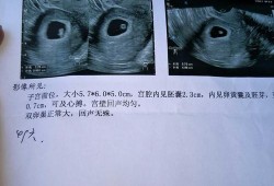 怀孕四十九天胎儿图片（怀孕49天能看到胚芽吗）