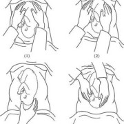胎儿触诊（胎儿触诊四步手法）