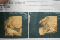 胎儿超一周（胎儿超一周）