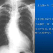 孕妇拍了x光怎么办，一次x线对孕早期有什么影响,孕期x线检查哪个部位对胎儿影响较大