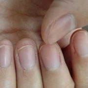孕期指甲（孕期指甲长得快是什么原因）
