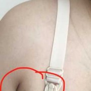 孕期副乳图（孕期副乳长大怎么办）
