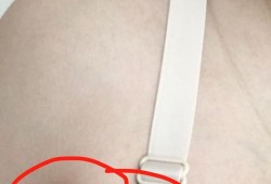 孕期副乳图（孕期副乳长大怎么办）