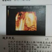 胎儿上唇厚（胎儿上唇皮肤）
