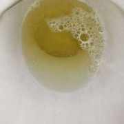 孕期尿液混浊（小便混浊是怎么了）