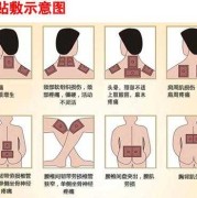 膏药对胎儿（膏药对胎儿有影响吗）