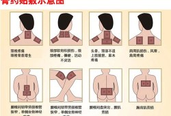 膏药对胎儿（膏药对胎儿有影响吗）