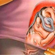 孕晚期嗜睡胎儿长得快（孕晚期老是想睡觉怎么回事）