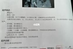 胎儿右心室强回声斑（胎儿右心室强回声斑）